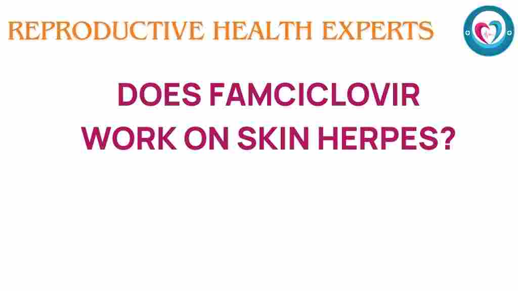 famciclovir-skin-herpes-treatment