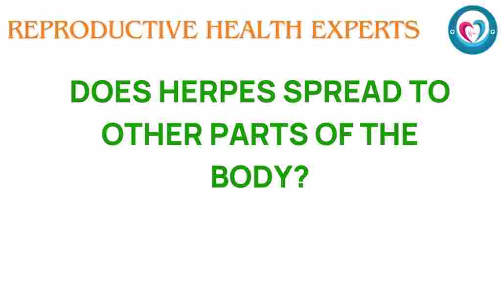 herpes-spread-beyond-boundaries