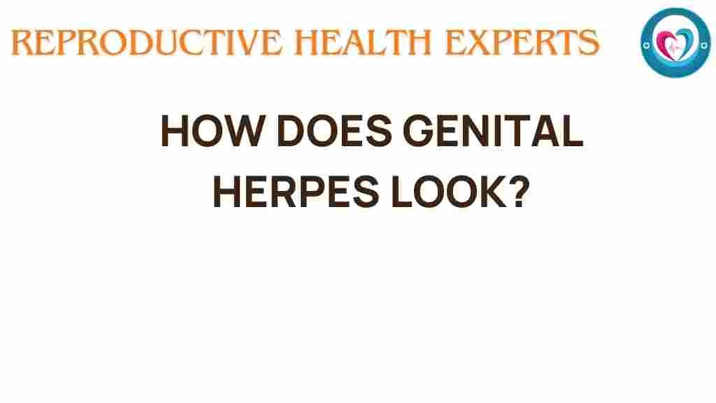 genital-herpes-visual-guide