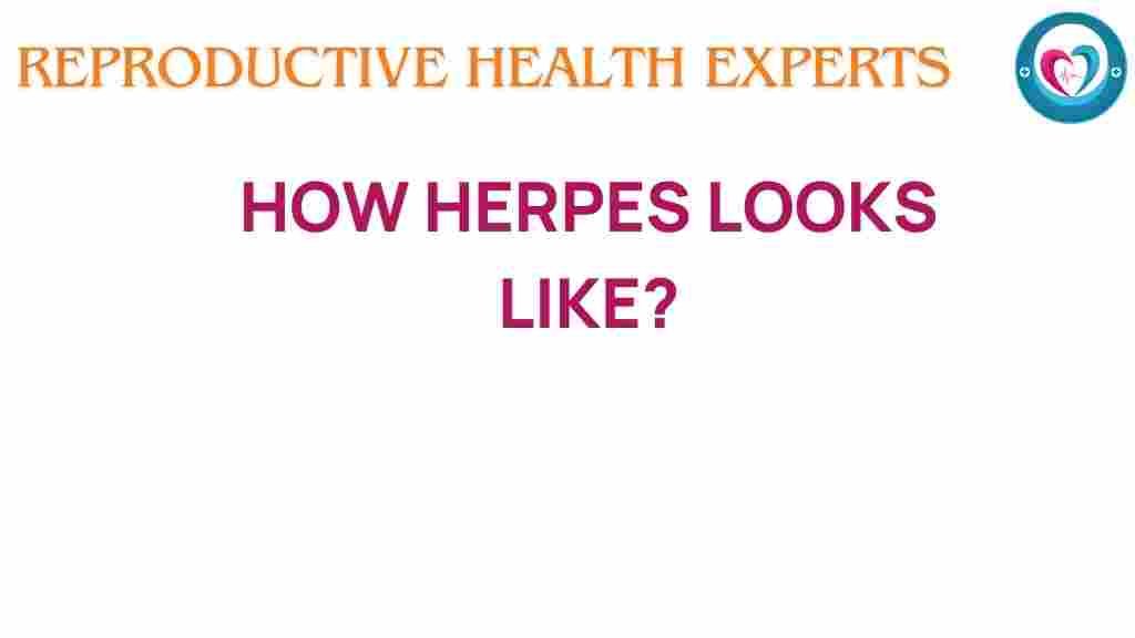 herpes-symptoms-and-appearance