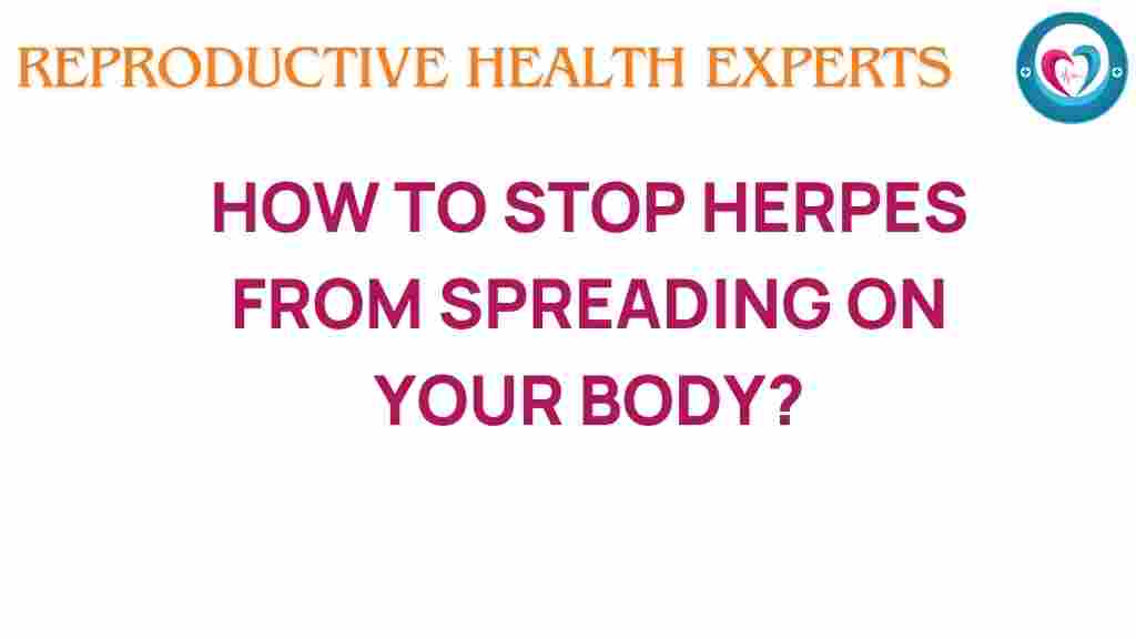 herpes-prevention-strategies
