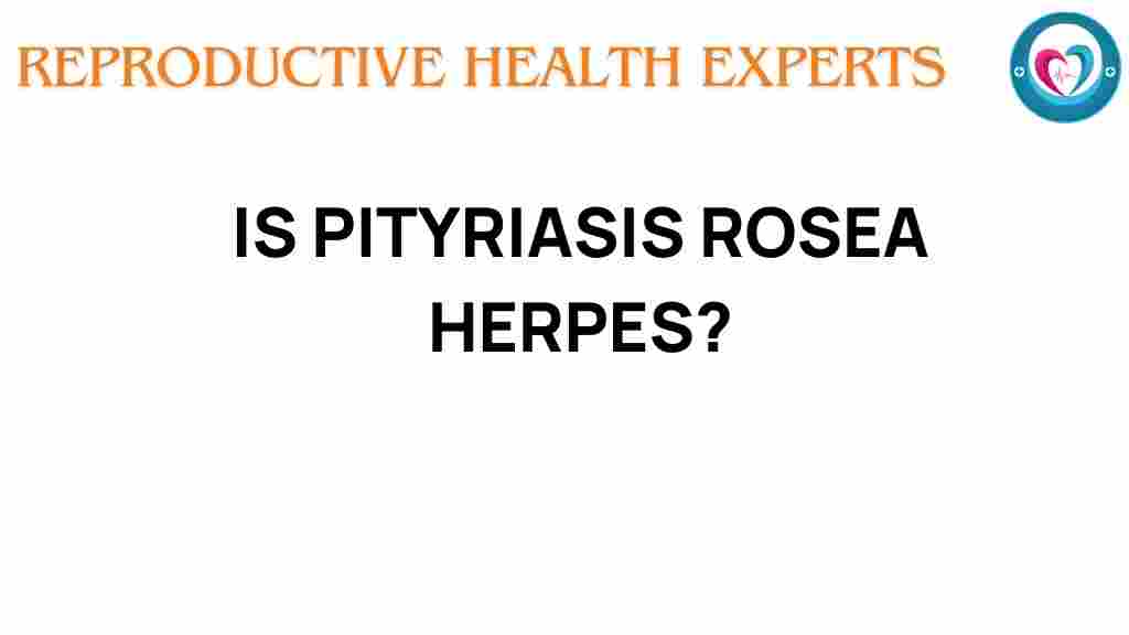 pityriasis-rosea-herpes